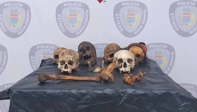 El joven con esquizofrenia tenía al mnos seis cráneos humanos