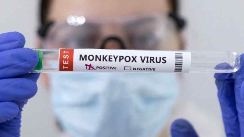 EEUU decreta emergencia sanitaria nacional por la viruela del mono