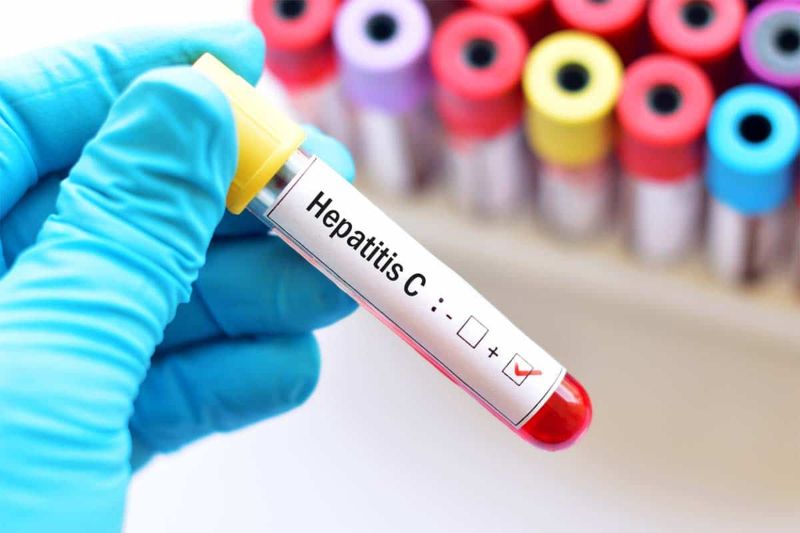 Hepatitis C registra incremento de contagio en Venezuela