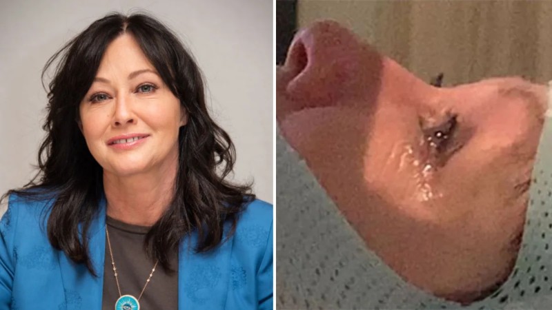 Shannen Doherty reveló que tiene metástasis en el cerebro