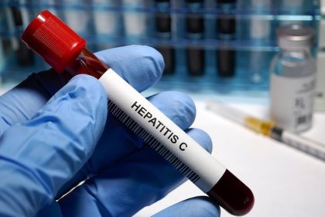 Aumentan casos de Hepatitis C en el país: una amenaza para los jóvenes