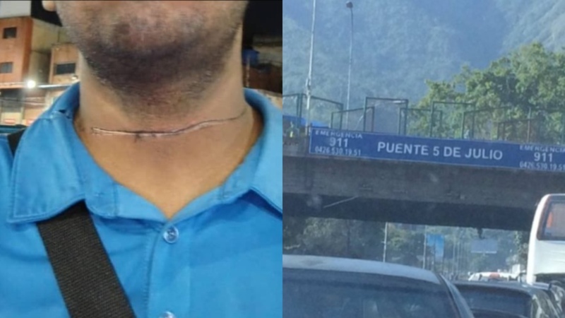 Motorizado casi muere degollado en una autopista de Caracas: Esta fue la insólita razón