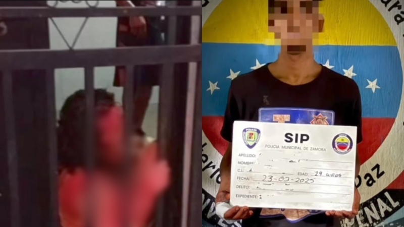 Mujer fue atacada a martillazos y puñadas en su propia casa en Guatire