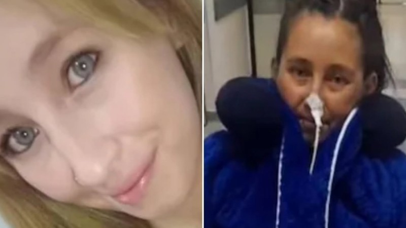 Fue por una cirugía simple y terminó sin una pierna y con trasplante de corazón