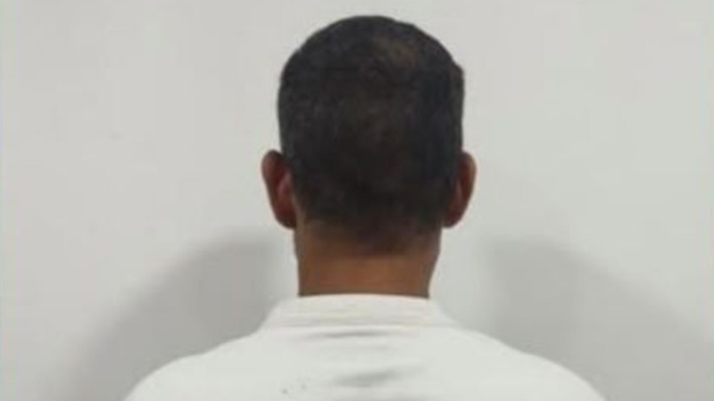 Se hacía pasar por cirujano para estafar a sus víctimas +MODUS OPERANDI