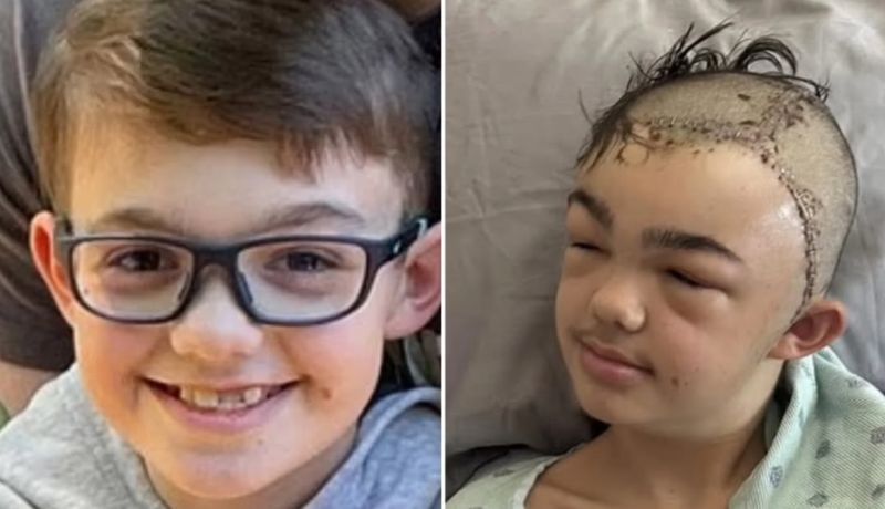 Fue brutalmente atacado por "una broma", y perdió partes de su cráneo