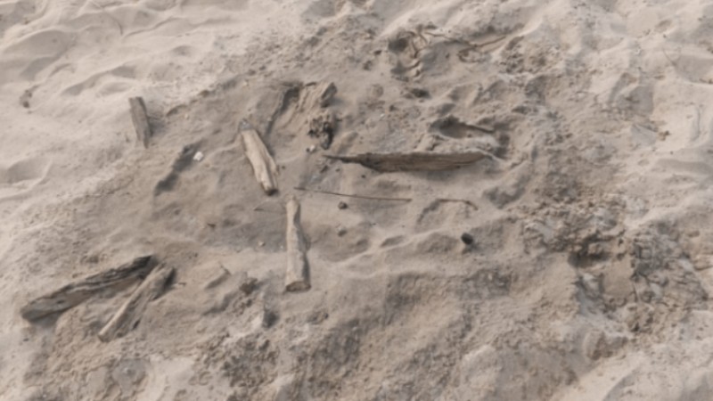 Niña de 3 años cayó en fogata ilegal en una playa de Anzoátegui: Su familia exige justicia