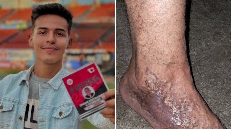 El grave deterioro de un estudiante de Comunicación Social detenido en Lara