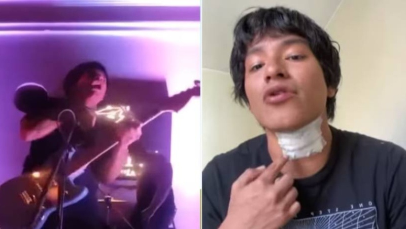 VIDEO VIRAL: El terrible descarga eléctrica que sufrió un cantante en pleno show