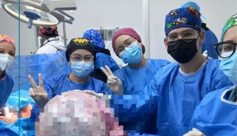 El impactante tumor de 25.5 kilos que le sacaron a una mujer en Anzoátegui +FOTOS