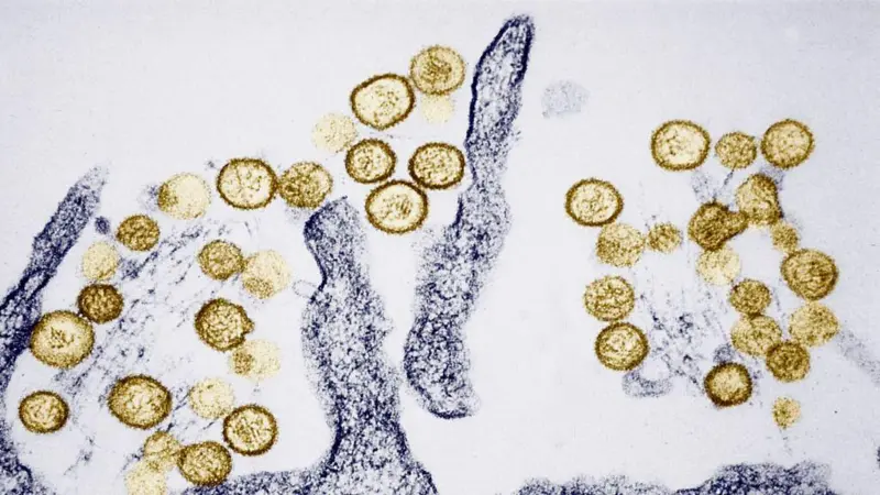 Qué es el hantavirus y cómo se trata tras confirmación de tres fallecidos