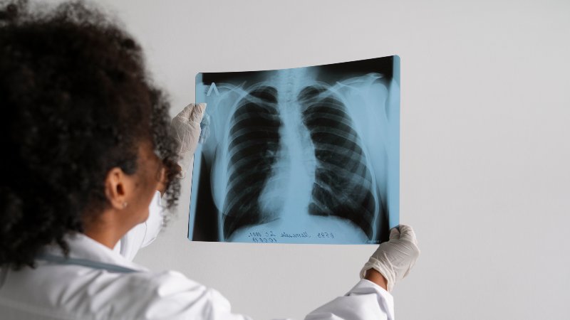 Cáncer de pulmón ocupa el segundo de 'amenazas para la salud' en Venezuela